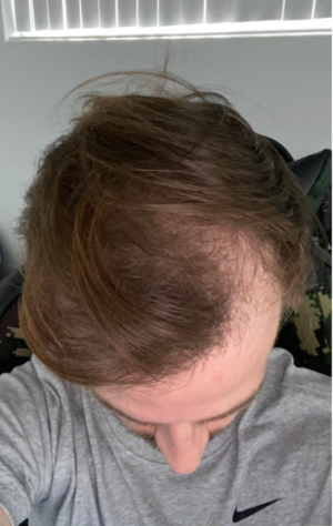 Derrick L. - Before