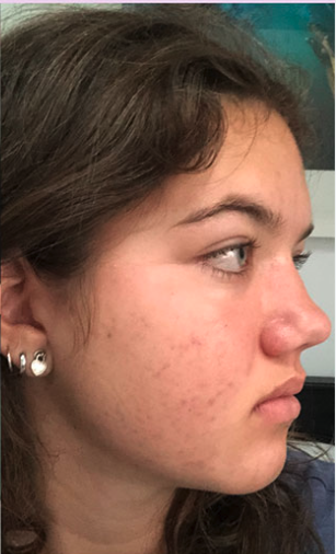 Maddie R. - After